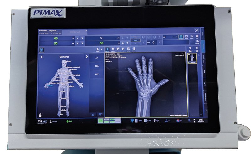 Generadores Pimax de alta frecuencia para diagnóstico de calidad constante